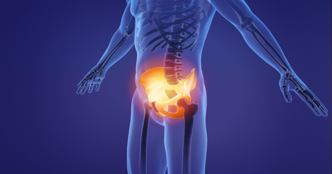 Pelvic Pain After Bowel Movements