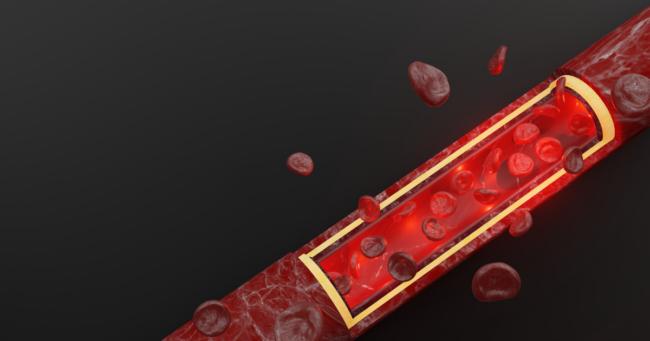 Recovering from Blood Loss