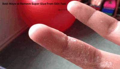 Best Ways to Remove Super Glue from Skin Fast